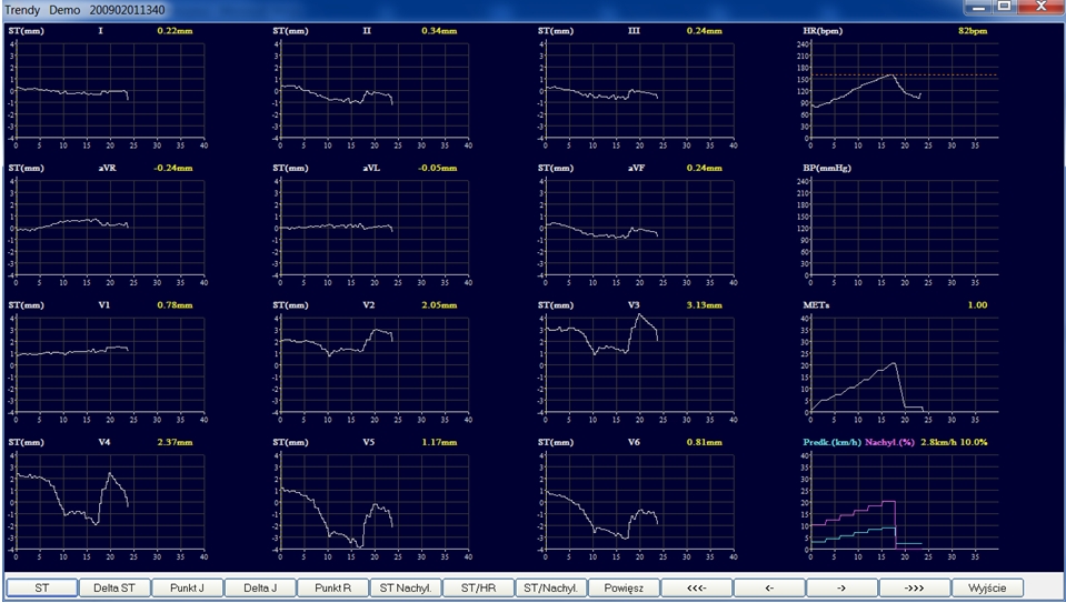 Systemy prób wysiłkowych DM Software CardioScan Stress Test 4.0