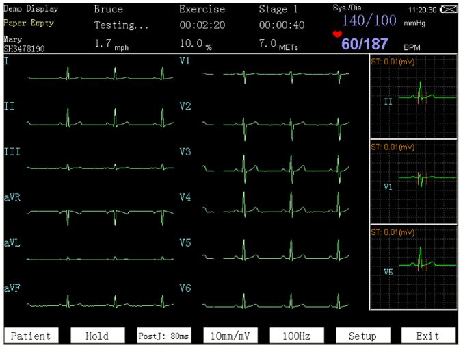 Systemy prób wysiłkowych EDAN SE-12 Express-Stress