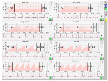 Systemy rehabilitacji kardiologicznej Dr. Gerhard Schmidt GmbH SmartCare