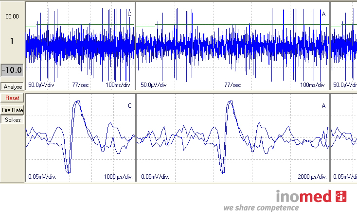 Systemy stereotaktyczne do neurochirurgii inomed Medizintechnik GmbH Microdrive