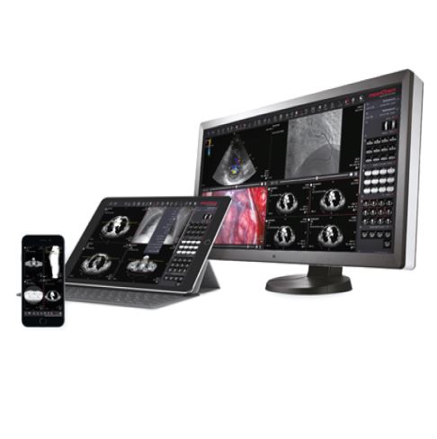 Systemy teleradiologii IT4KAN KaPACS Teleradiologia