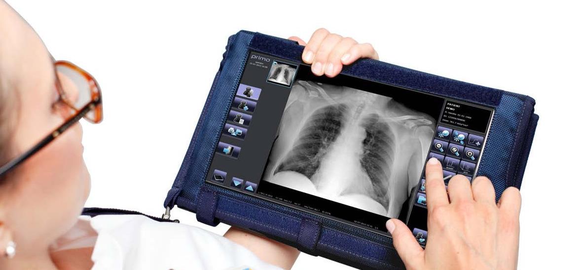 Systemy ucyfrowienia aparatów rentgenowskich Primax PRIMO W