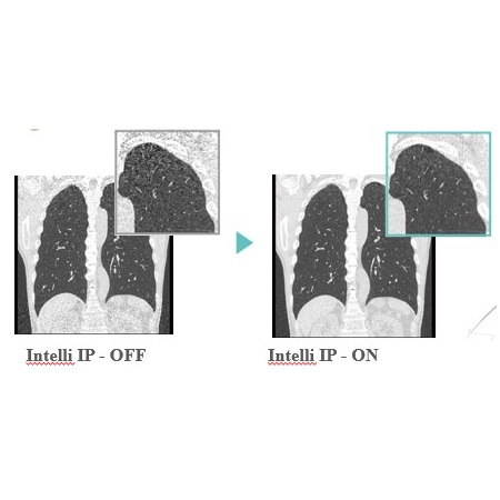 Tomografy komputerowe (CT) FUJIFILM FCT Speedia