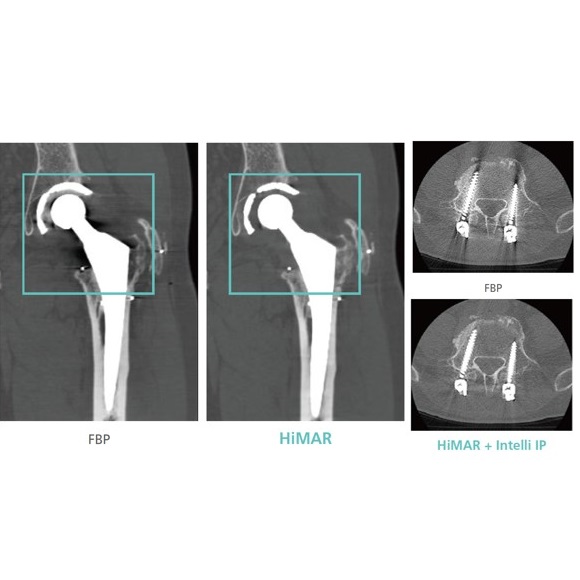 Tomografy komputerowe (CT) FUJIFILM FCT Speedia