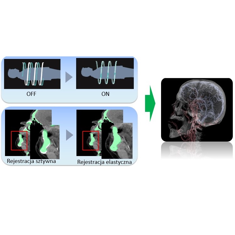 Tomografy komputerowe (CT) FUJIFILM FCT Speedia