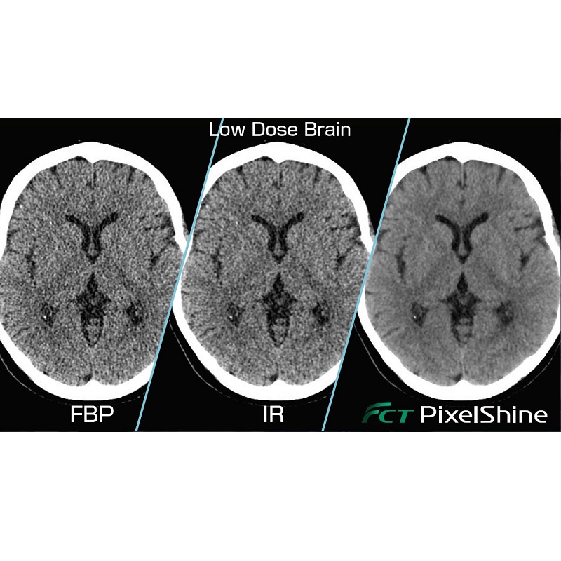 Tomografy komputerowe (CT) FUJIFILM FCT Speedia