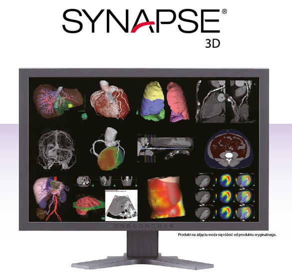 Tomografy komputerowe (CT) FUJIFILM FCT Speedia