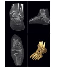 Tomografy komputerowe mobilne Planmed Verity