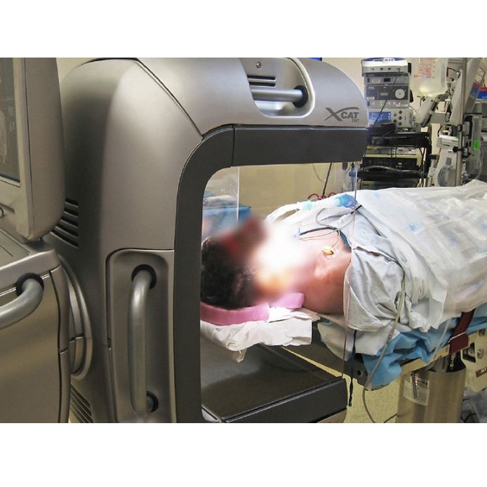 Tomografy komputerowe mobilne Xoran xCAT