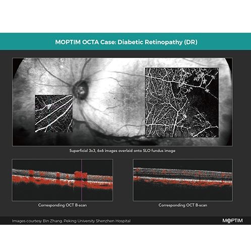 Tomografy okulistyczne (OCT) Moptim Mocean 4000