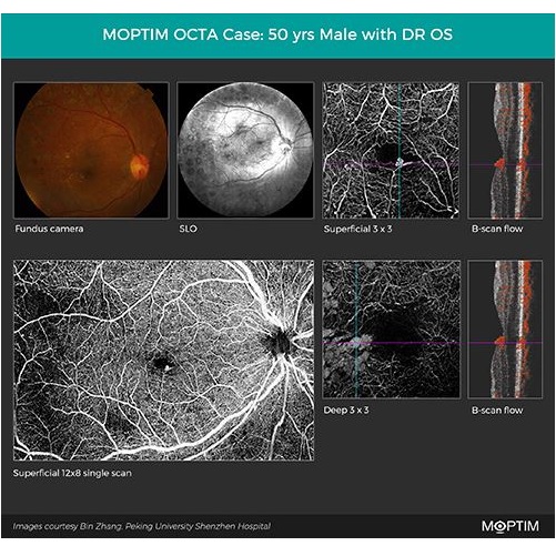 Tomografy okulistyczne (OCT) Moptim Mocean 4000