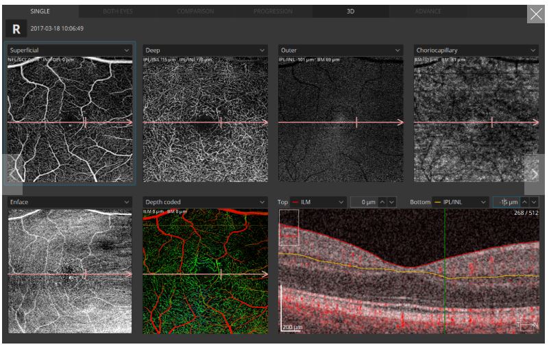 Tomografy okulistyczne (OCT) OPTOPOL REVO 80