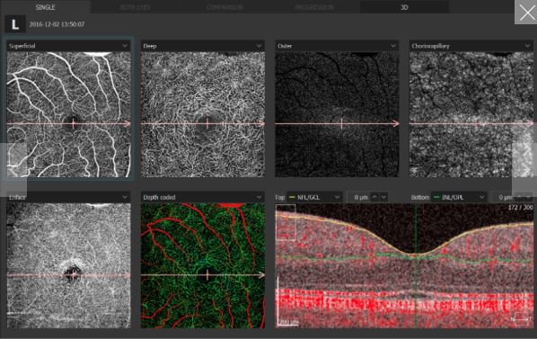 Tomografy okulistyczne (OCT) OPTOPOL REVO NX
