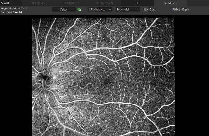 Tomografy okulistyczne (OCT) OPTOPOL REVO NX