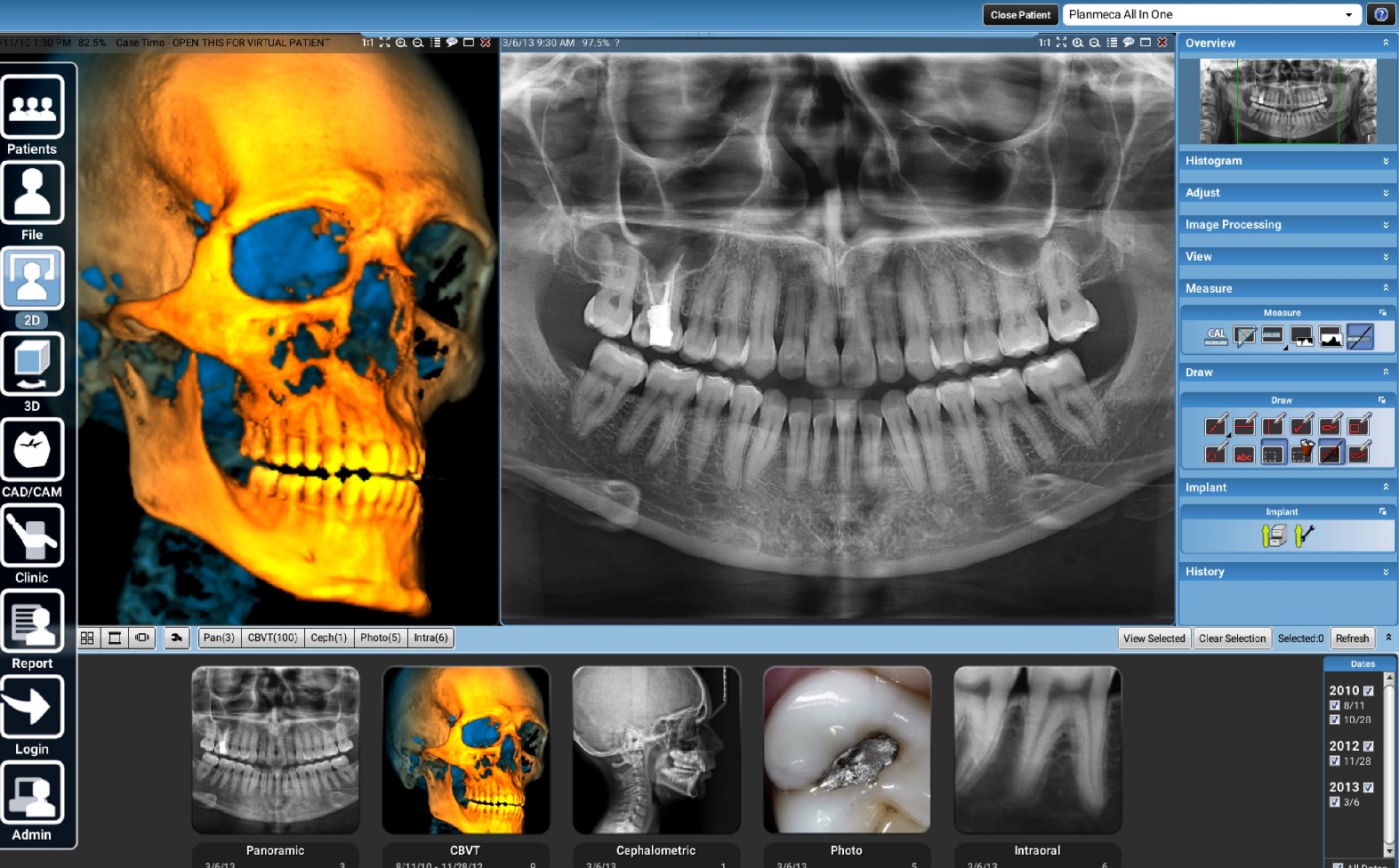 Tomografy stomatologiczne Planmeca ProMax 2D