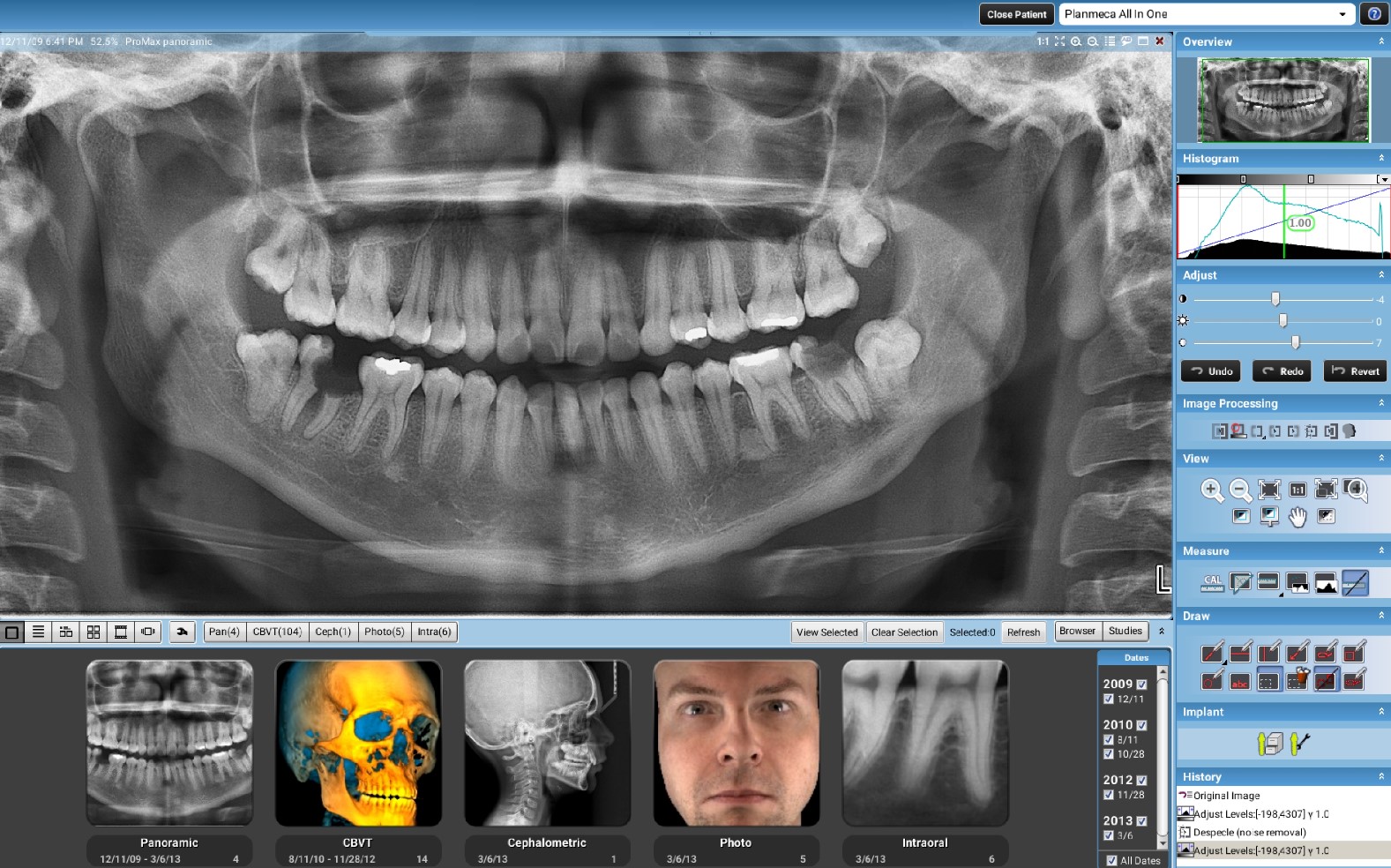 Tomografy stomatologiczne Planmeca ProMax 2D