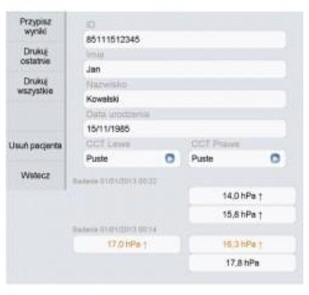 Tonometry bezkontaktowe FREY TN-100