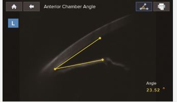 Tonometry bezkontaktowe HUVITZ HNT-1/HNT-1P