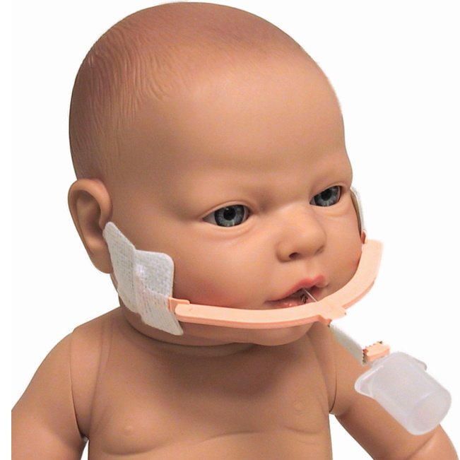 Uchwyty do rurek intubacyjnych NEOTECH NeoBar