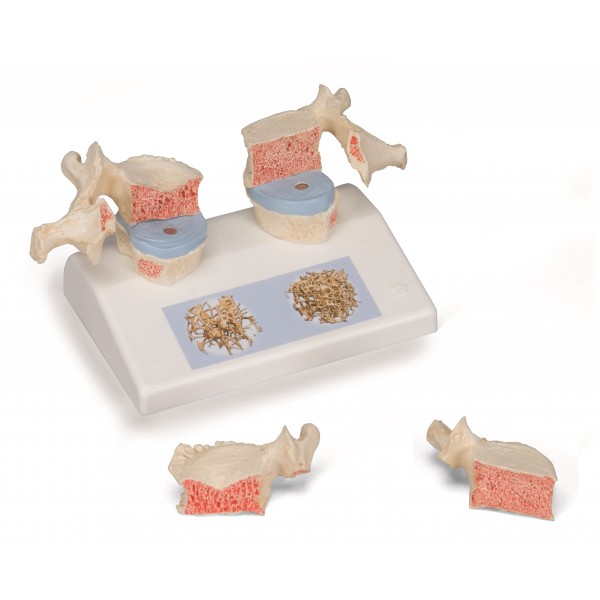 Układ kostny 3B Scientific A95