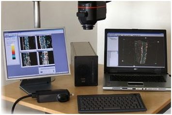 Ultrasonografy dermatologiczne Cortex Technology DermaScan C