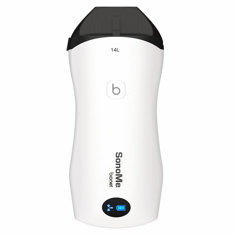 Ultrasonografy kieszonkowe ręczne (USG) Bionet SonoMe 14L