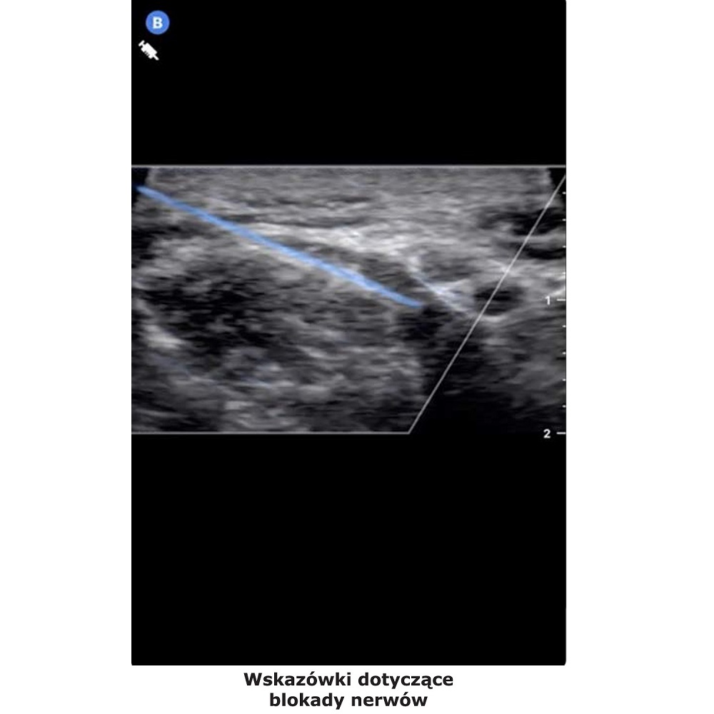 Ultrasonografy kieszonkowe ręczne (USG) Butterfly iQ+