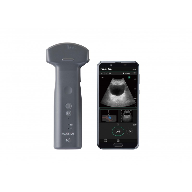 Ultrasonografy kieszonkowe ręczne (USG) FUJIFILM iViz