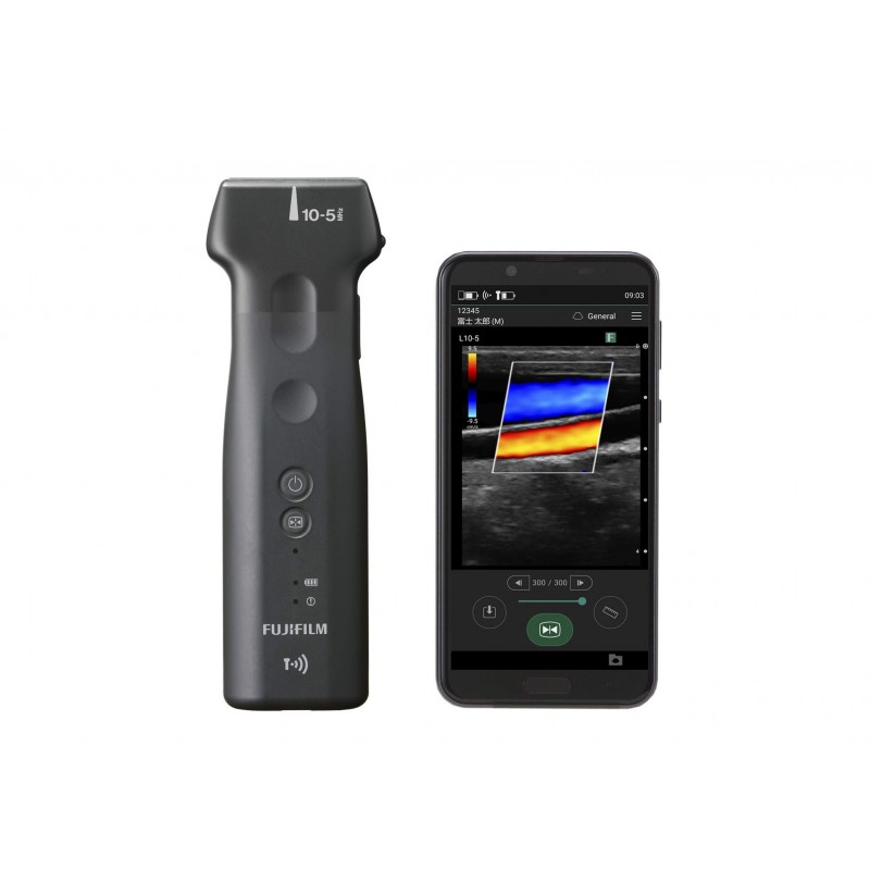 Ultrasonografy kieszonkowe ręczne (USG) FUJIFILM iViz
