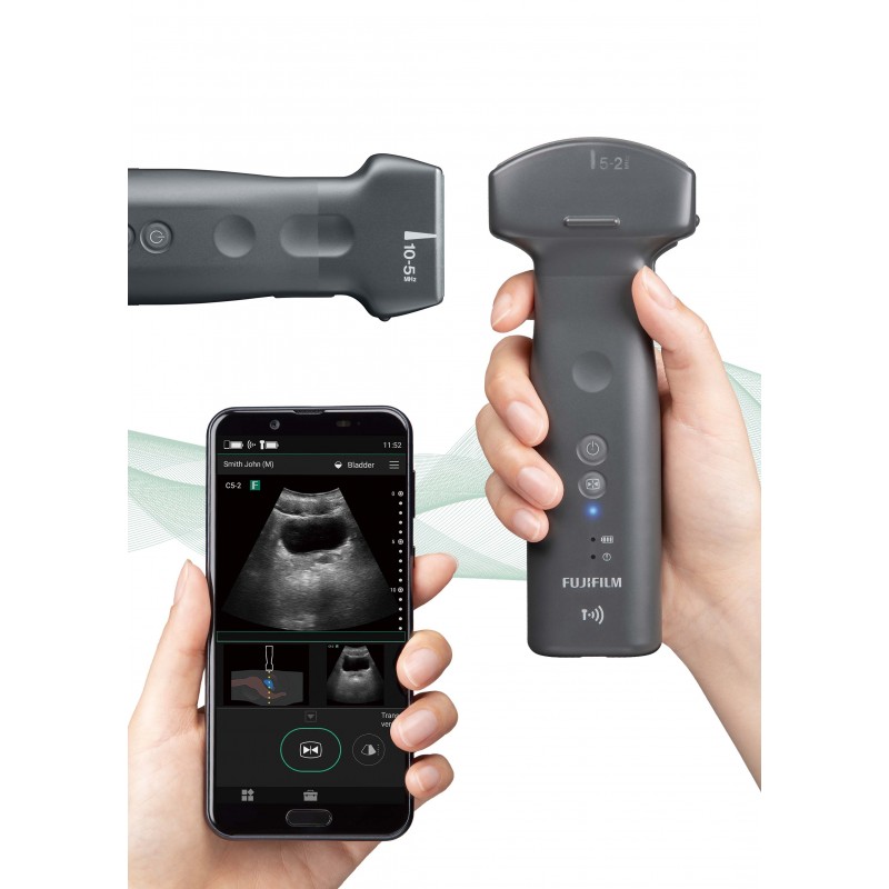 Ultrasonografy kieszonkowe ręczne (USG) FUJIFILM iViz