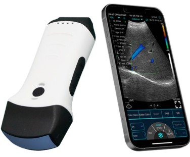 Ultrasonografy kieszonkowe ręczne (USG) Konted C10TX