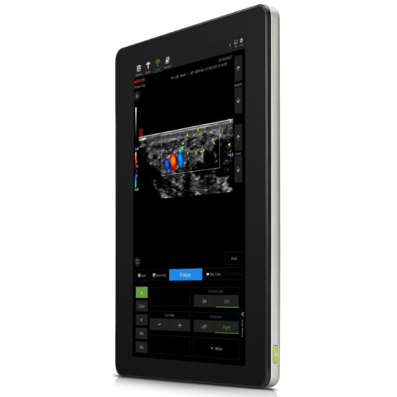 Ultrasonografy kieszonkowe ręczne (USG) Wisonic Piloter