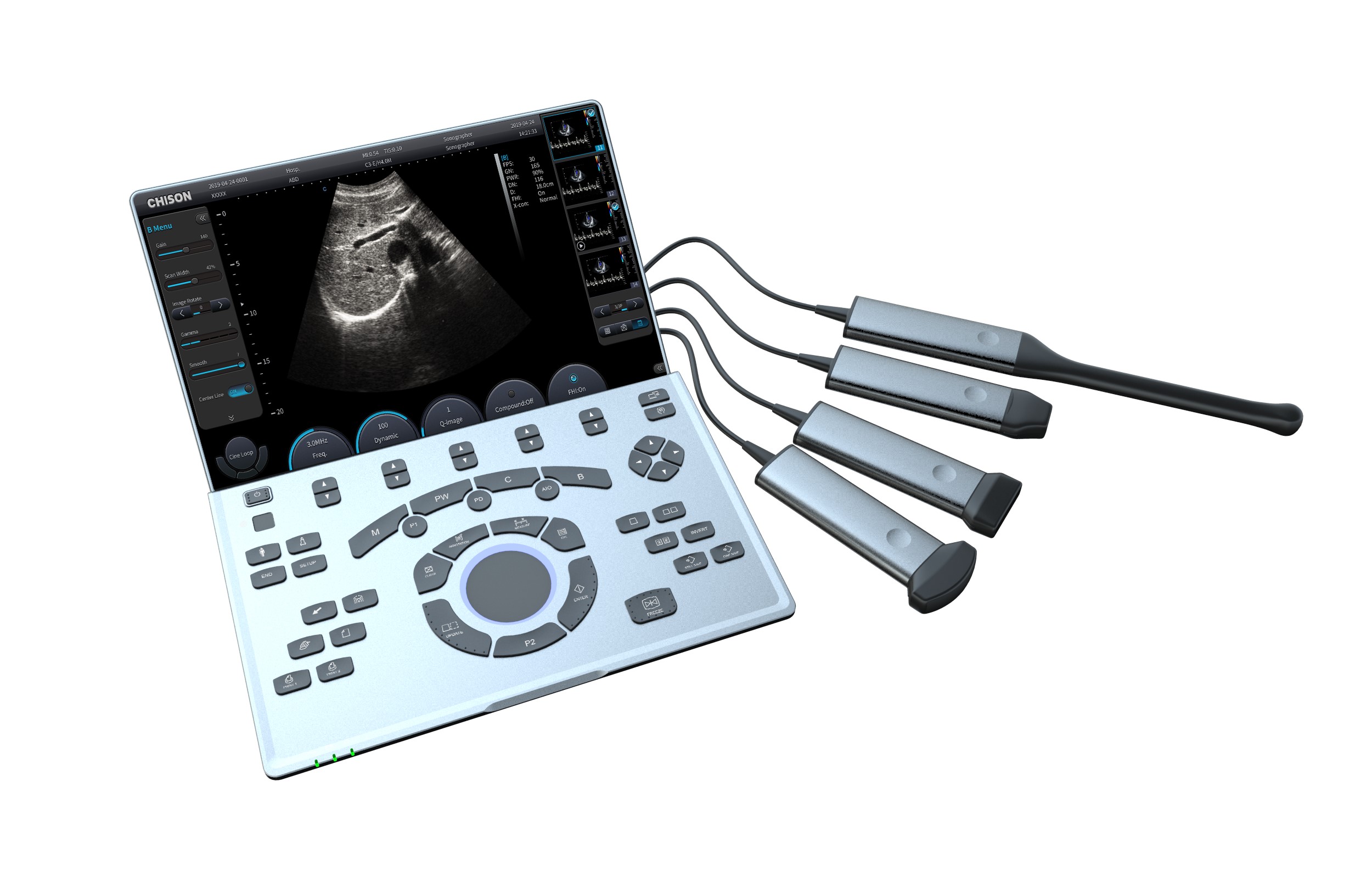 Ultrasonografy mobilne przyłóżkowe CHISON SonoAIR 30