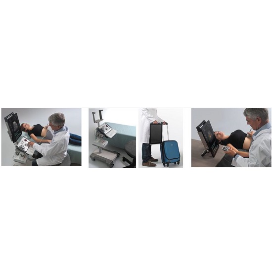 Ultrasonografy mobilne przyłóżkowe ECHO-SON ALBIT Duplex Doppler