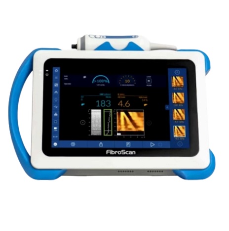 Ultrasonografy mobilne przyłóżkowe Echosens FibroScan Mini+ 430