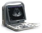 Ultrasonografy mobilne przyłóżkowe SonoScape A6