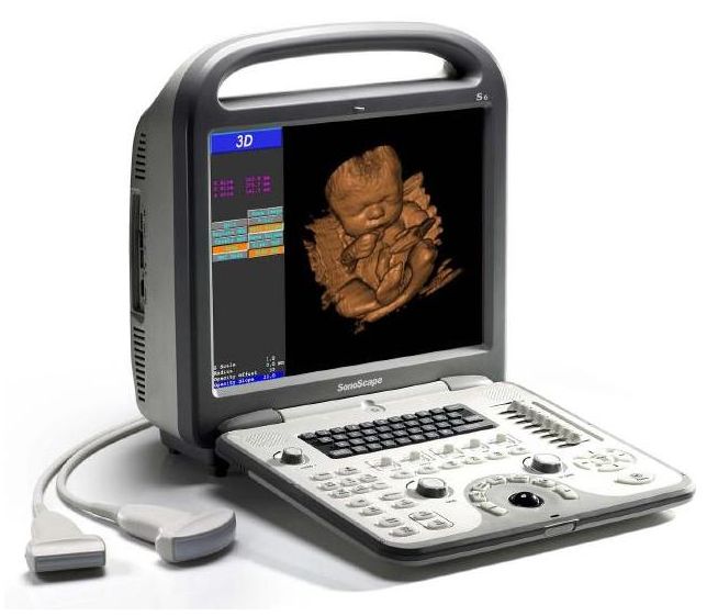 Ultrasonografy mobilne przyłóżkowe SonoScape S6 / S6 BW