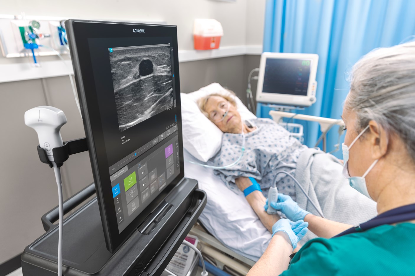 Ultrasonografy mobilne przyłóżkowe SonoSite SonoSite ST