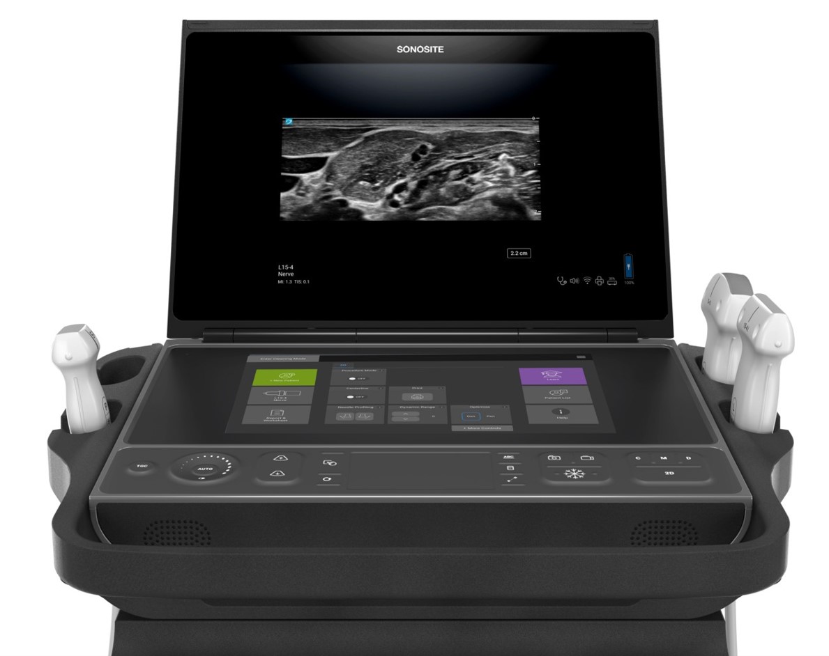 Ultrasonografy mobilne przyłóżkowe SonoSite SonoSite ZX