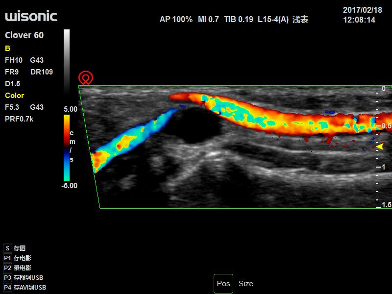 Ultrasonografy mobilne przyłóżkowe Wisonic Clover 60
