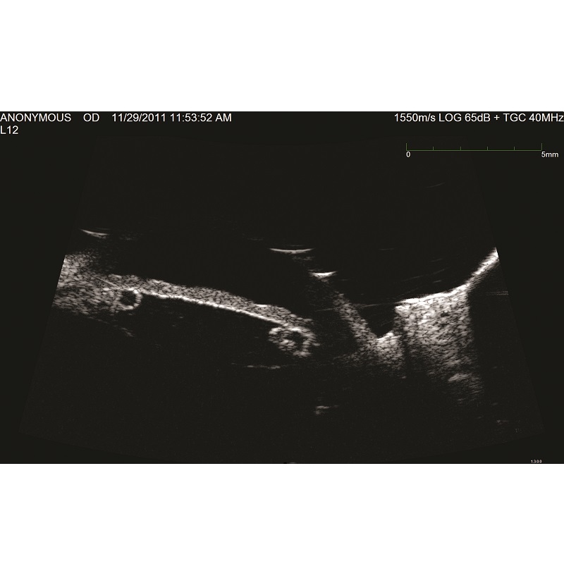 Ultrasonografy okulistyczne Ellex Eye Cubed