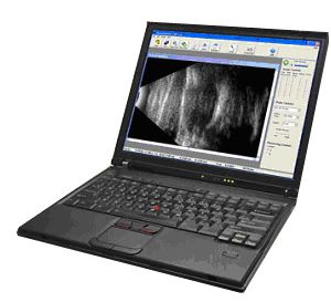 Ultrasonografy okulistyczne Micromed B-Scan