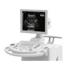 Ultrasonografy stacjonarne wielonarządowe - USG CHISON 8500