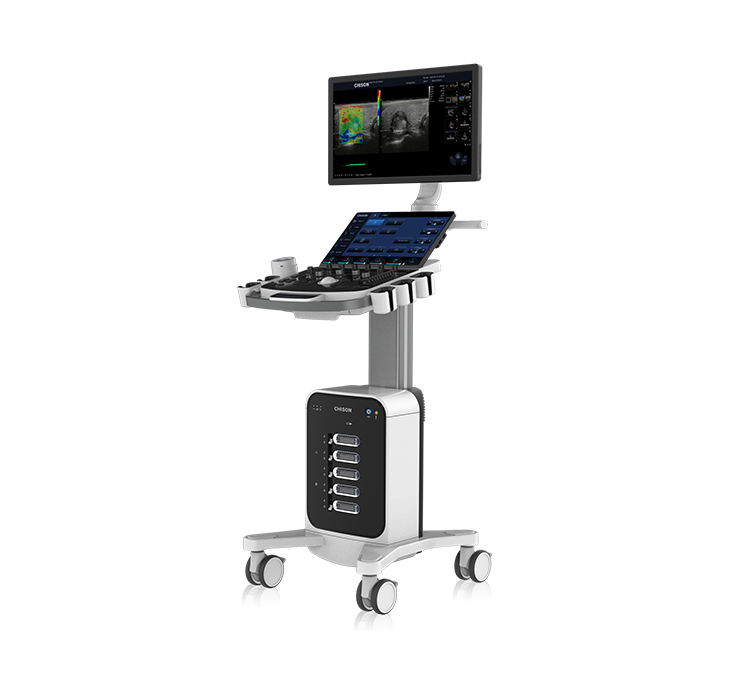 Ultrasonografy stacjonarne wielonarządowe - USG CHISON SonoMax9
