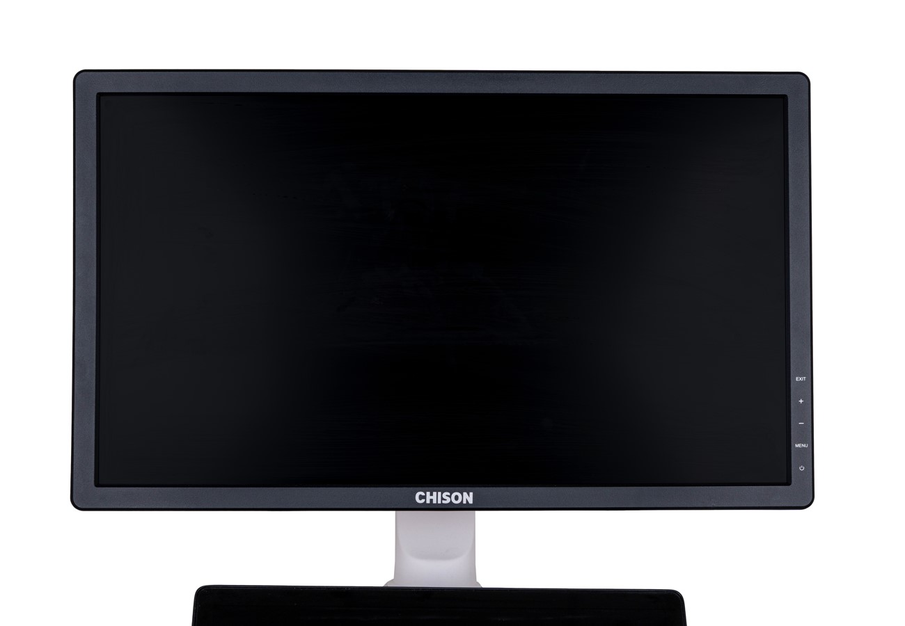 Ultrasonografy stacjonarne wielonarządowe - USG CHISON SonoMax9