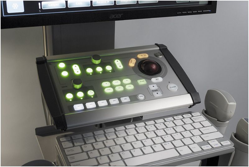 Ultrasonografy stacjonarne wielonarządowe - USG ECHO-SON SPINEL II TS Color Doppler