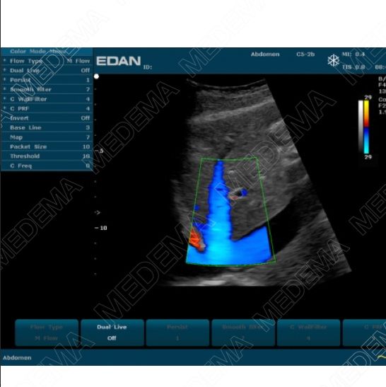 Ultrasonografy stacjonarne wielonarządowe - USG EDAN U2