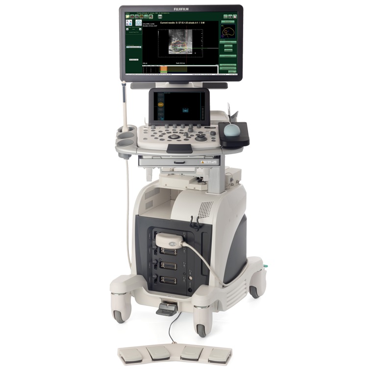 Ultrasonografy stacjonarne wielonarządowe - USG FUJIFILM ARIETTA 65 IntuitiveFusion