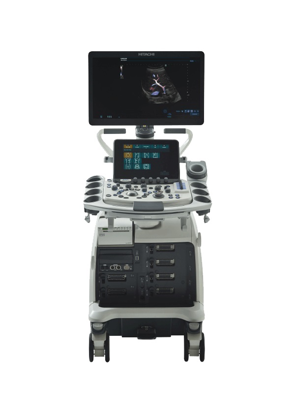 Ultrasonografy stacjonarne wielonarządowe - USG FUJIFILM Arietta 750 VE
