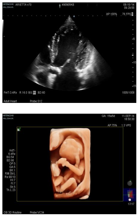 Ultrasonografy stacjonarne wielonarządowe - USG FUJIFILM ARIETTA V60